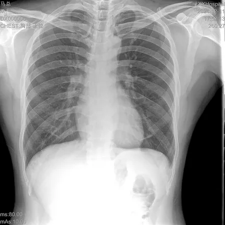 Chest radiograph