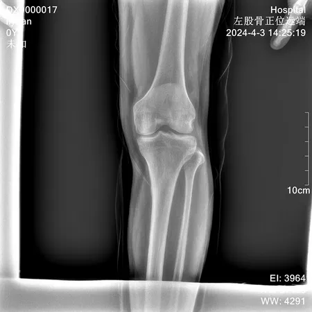 Limb radiograph