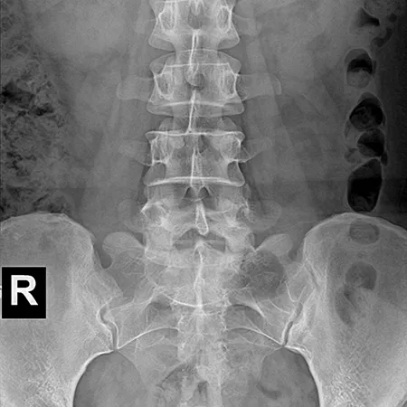 Abdominal radiograph