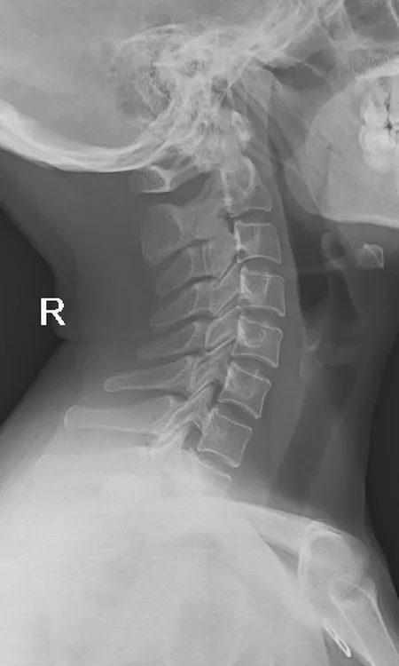 Head radiograph