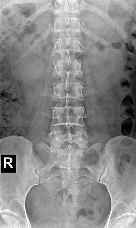 Abdominal radiograph