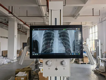 SHO-DDX05 Floor-mounted Digital X-ray Machine