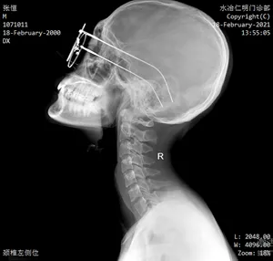 Ceiling-Mounted X-Ray Machine