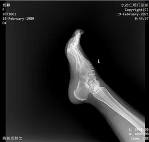 Ceiling-Mounted X-Ray Machine