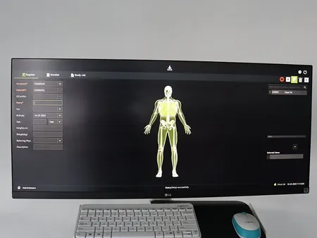 C-Arm Machine with Flat Panel Detector