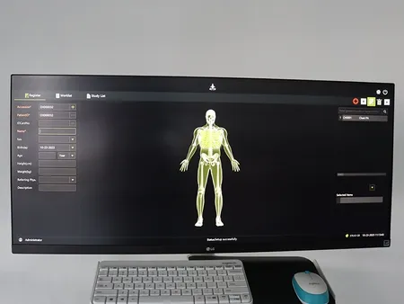 C-Arm Machine with Flat Panel Detector