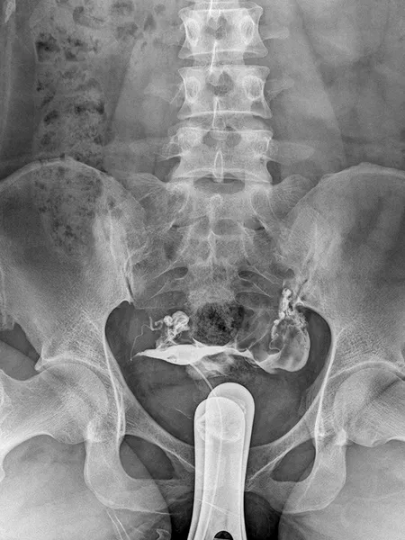 Reproductive System radiograph