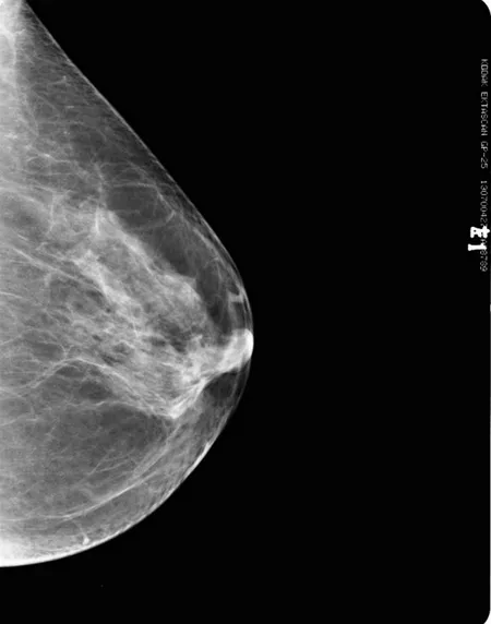 Normal breast images
