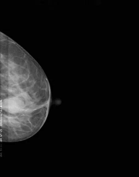 Normal breast images
